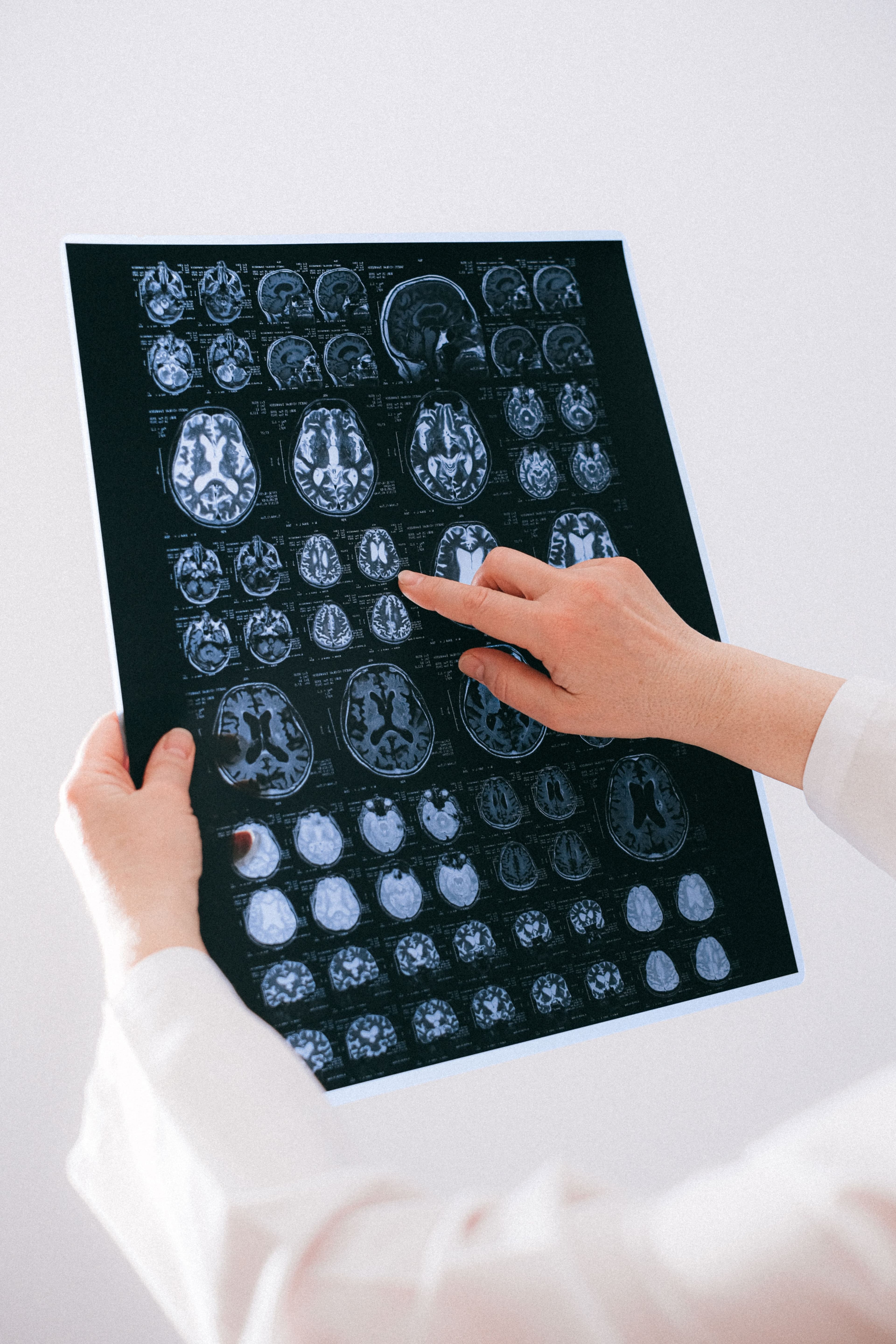 Profissional de saúde analisando ressonância magnética cerebral em ambiente clínico